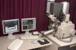 Electron Microscopy